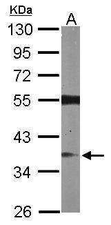 RASSF2 antibody [N1C3]