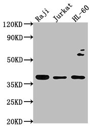 RASSF2 Antibody