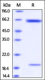Rat PCSK9 Protein
