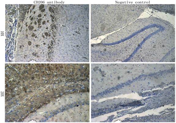 CD206 antibody