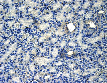 CD206 antibody