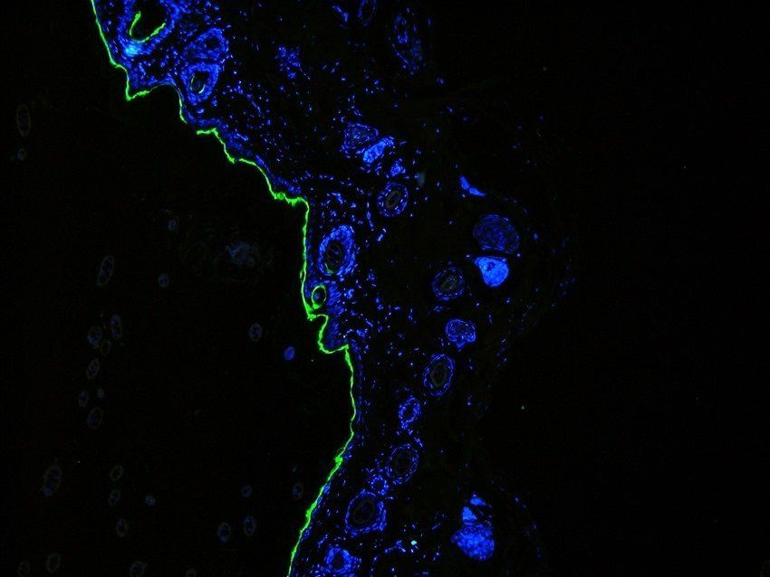 ROR gamma T antibody