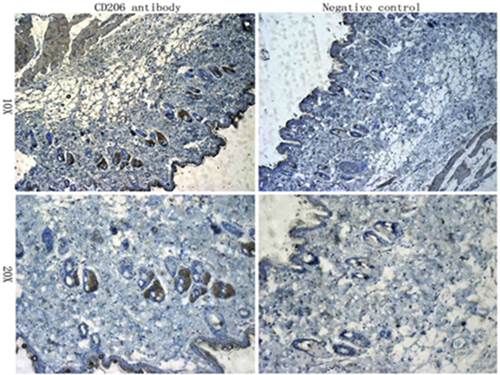 CD206 antibody