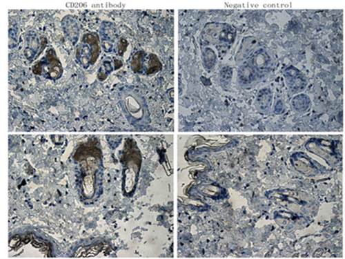 CD206 antibody