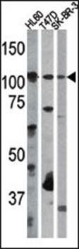 RB (phospho-Ser612) antibody