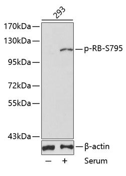 RB (Phospho-S795) antibody