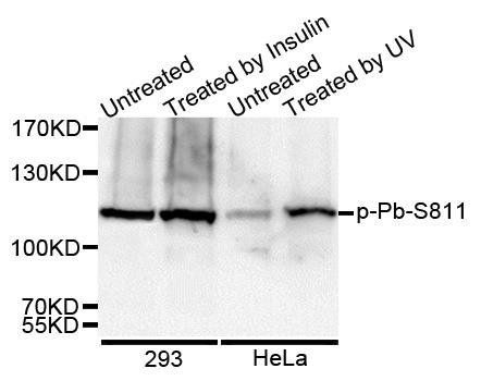RB (phospho-S811) antibody