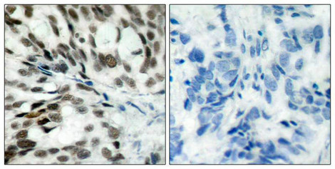 RB1 Antibody
