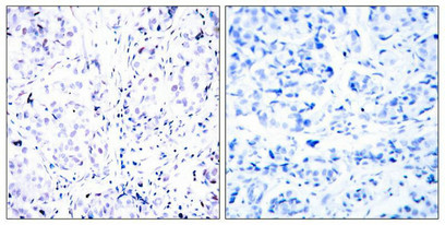 RB1 Antibody