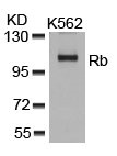 RB1 (Ab-807) antibody