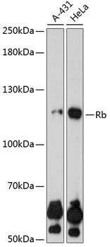 RB1 antibody