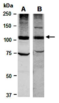 RB1 (M) Antibody, Rabbit Polyclonal