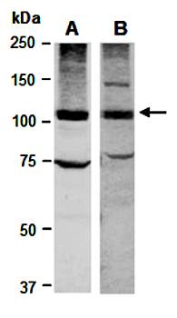 RB1 (vPairTM) Antibodies