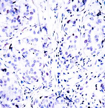 Rb (Ab-807) Antibody