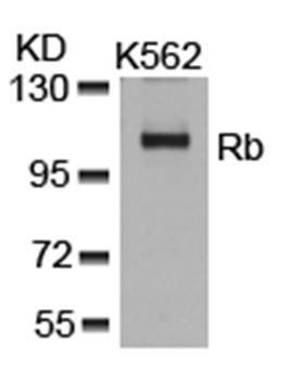 Rb (Ab-807) Antibody