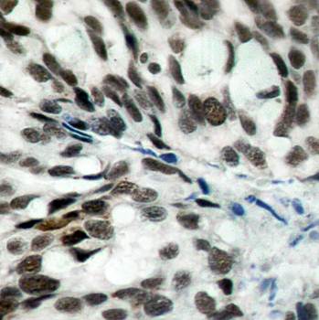 Rb (Ab-780) Antibody
