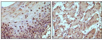 RB Antibody