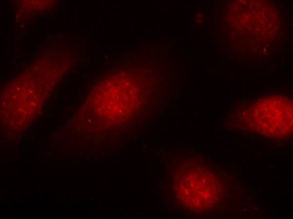 Rb (Phospho-Ser780) Antibody