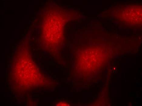 Rb (Phospho-Ser795) Antibody