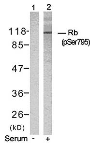 Rb (Phospho-Ser795) Antibody