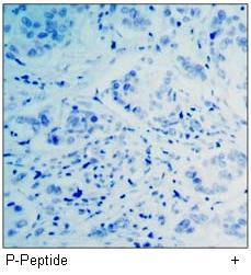 Rb (Phospho-Ser807) Antibody