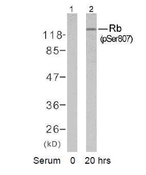 Rb (Phospho-Ser807) Antibody