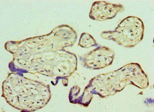 RBBP5 Antibody