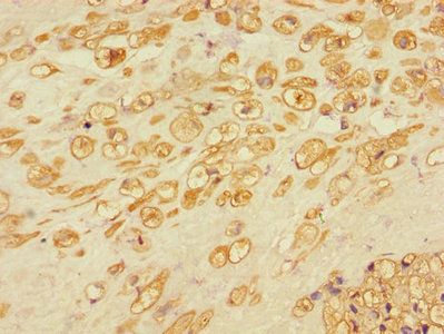 RBBP8 Antibody