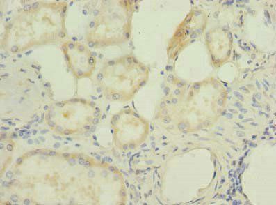 RBBP9 Antibody