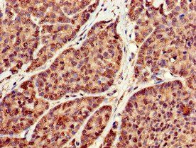 RBFA Antibody