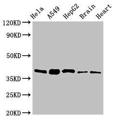 RBFA antibody