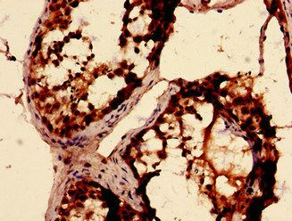 RBKS Antibody