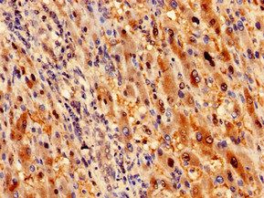 RBKS Antibody