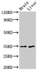 RBKS Antibody