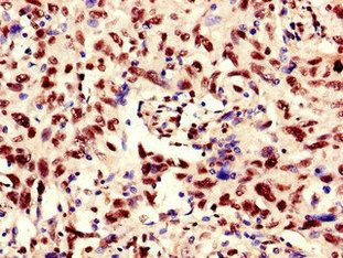 RBM10 Antibody