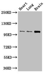 RBM10 antibody