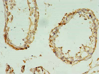 RBM11 Antibody