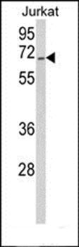 RBM14 antibody