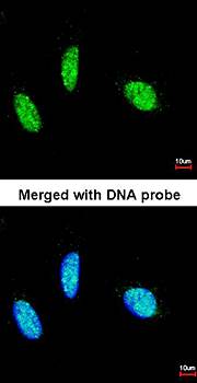 RBM15 antibody