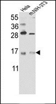 RBM3 antibody