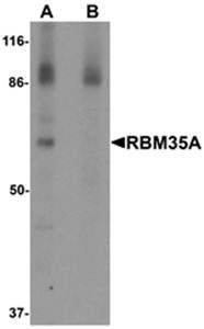 RBM35A Antibody