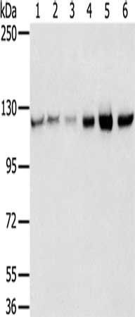 RBM5 antibody