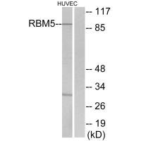 RBM5 antibody