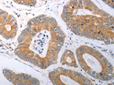 RBMS3 Antibody