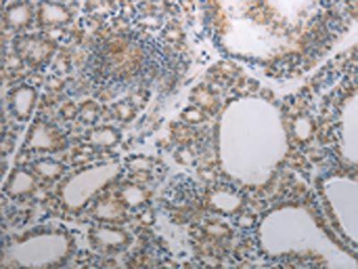 RBMS3 Antibody