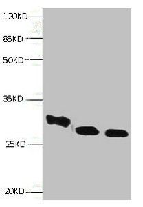 RBP4 Monoclonal Antibody