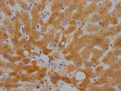 RBP4 Recombinant Monoclonal Antibody