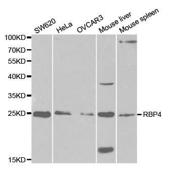 RBP4 antibody