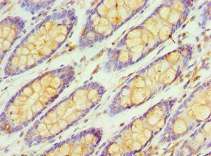 RBX1 Antibody