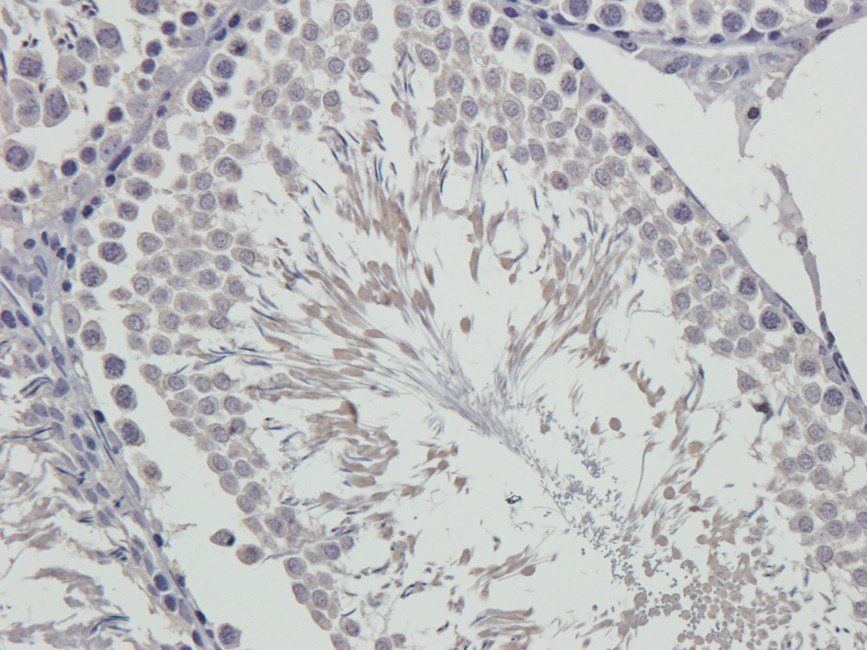 RCAN1 antibody